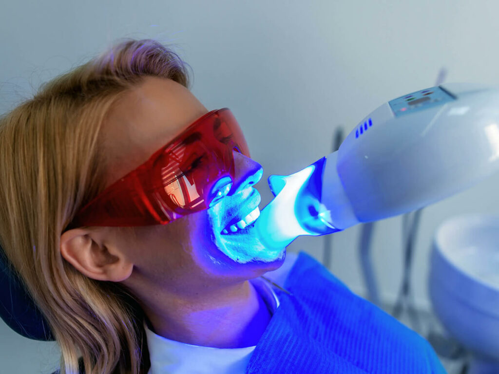 Woman receiving a light activated professional teeth whitening